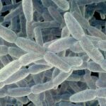 Fourth Fatality Confirmed in Upper East Side Legionnaires’ Cluster