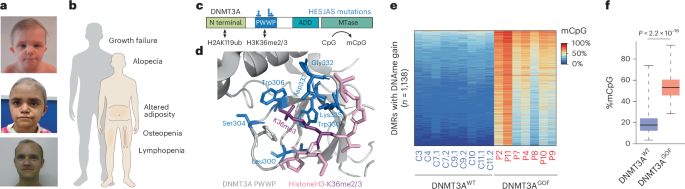 Understanding the HESJAS Disease Model