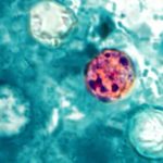 The Scope of the Outbreak