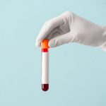 Blood Test Predicts Cognitive Decline a Decade Before Symptoms