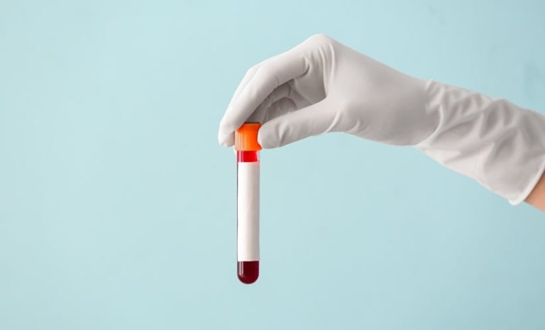 Blood Test Predicts Cognitive Decline a Decade Before Symptoms