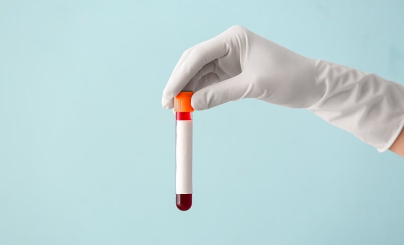 Blood Test Predicts Cognitive Decline a Decade Before Symptoms