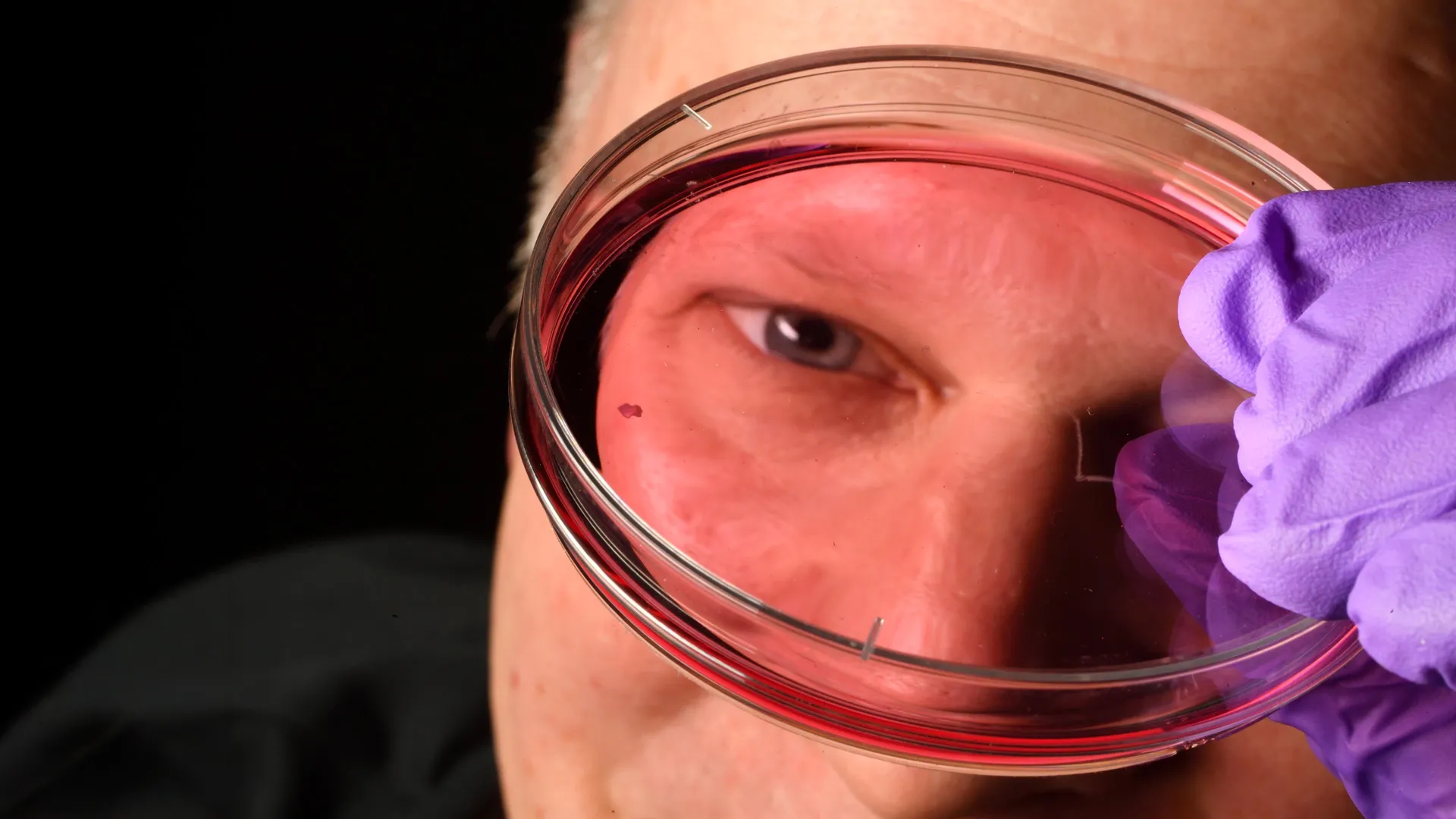 Retinal Development and the Foveola Transformation