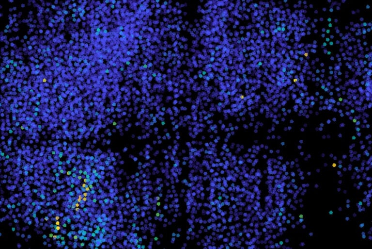 MIT Engineers Develop High-Speed Microscope for Whole-Brain Voltage Imaging