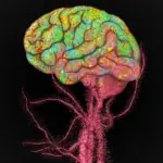 Stanford Scientists Discover Immune Cells Flood Aging Brain
