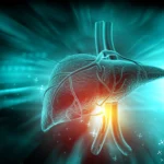 Ketogenic Diet Reduces Liver Fat Better Than Other Diets