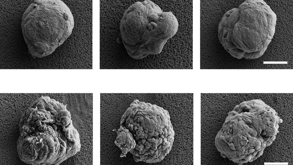 Penn State Researchers Shield Donor Cells With Hydrogel Invisibility Cloaks