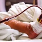 Antibiotic Resistance in Children Rose Globally From 2004 to 2022