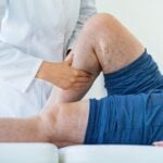 Deep Vein Thrombosis: Symptoms, Risks and Prevention Management