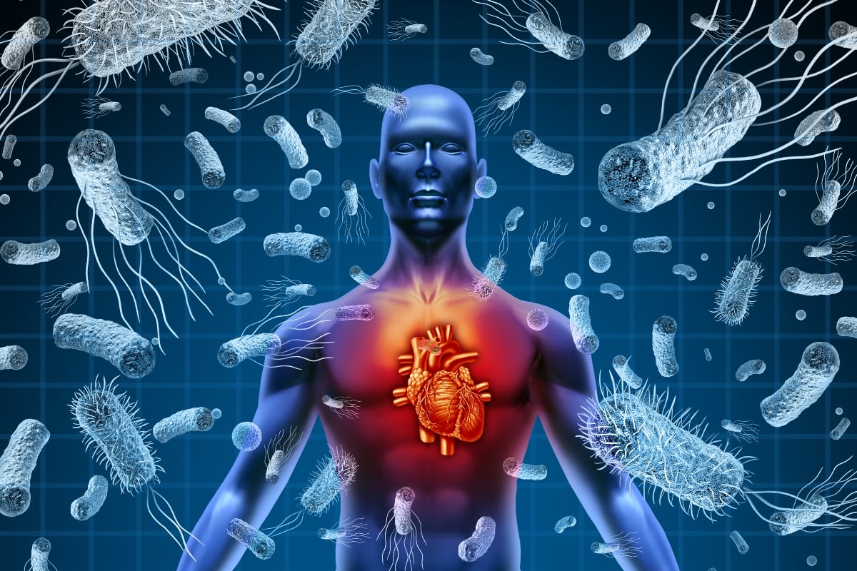Monaldi Hospital Study Reveals Microbiota Differences in Endocarditis Patients