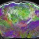 Stanford Researchers Transplant Human Brain Organoids Into Mice