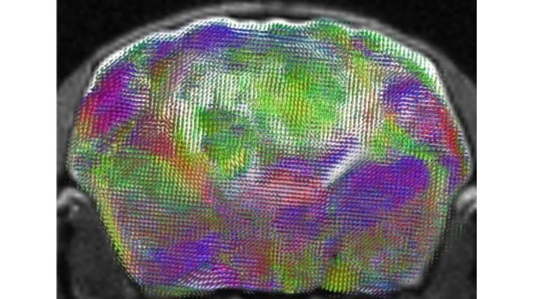 Stanford Researchers Transplant Human Brain Organoids Into Mice