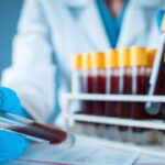 UTHealth Houston Researchers Find Protein Signatures Predict Future Disease Risk