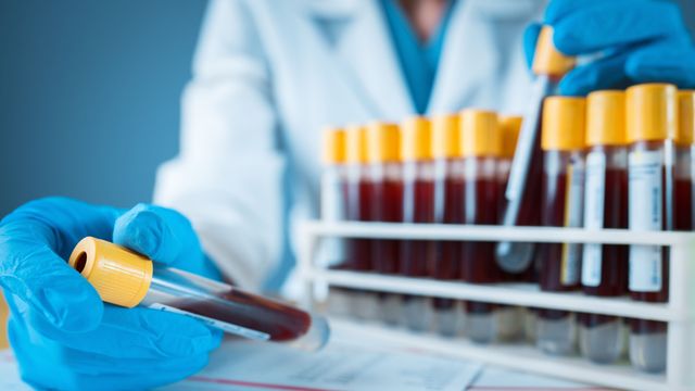 UTHealth Houston Researchers Find Protein Signatures Predict Future Disease Risk